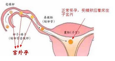 早早孕天天喝酒_早早孕天数怎么计算_早早孕相当于多少天